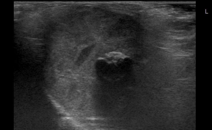 3230--5_20210319_Thyroid_0002-2jpeg.jpg