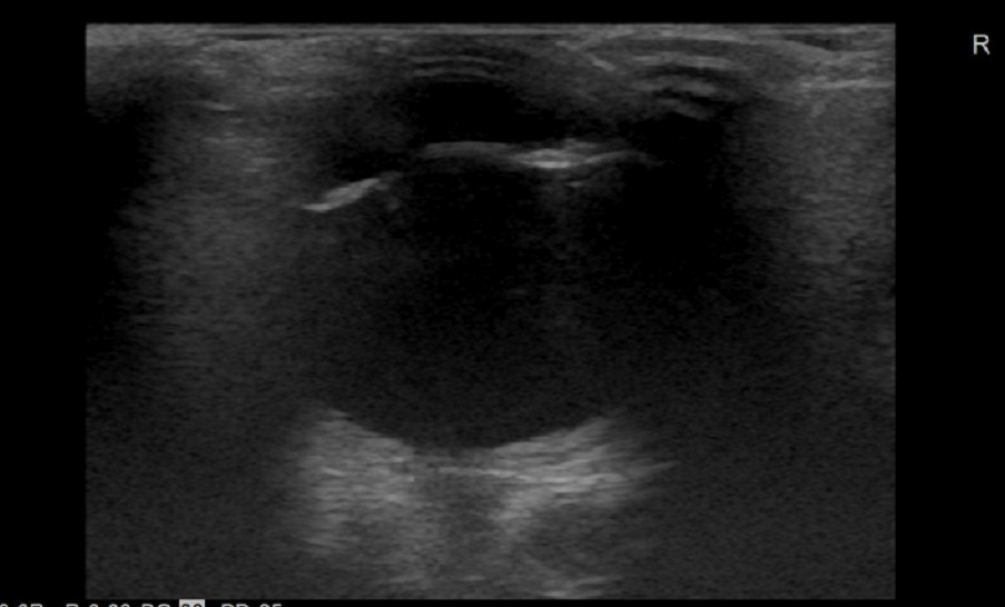 3230--5_20210319_Thyroid_0008-2jpeg.jpg